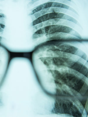 Die Diagnose "Krebs" verändert das Leben!