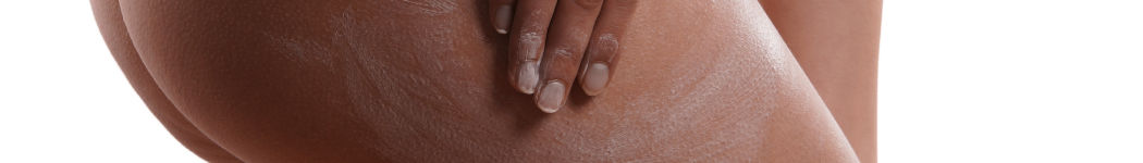 Mit der Kraft der Aloe Vera bestmöglich gegen Cellulite vorbeugen und wirken