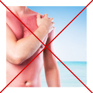 Sonnenbrand. Wenn es zu spät ist für Sonnenschutz.